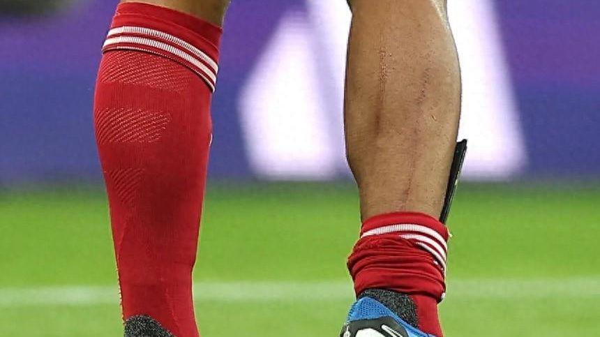 开云体育下载-范戴克腿上伤痕触目惊心，怒斥对手：不罚下就没天理了